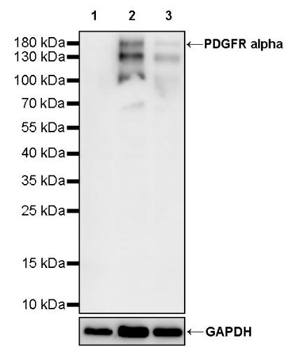 PDGFR alpha Recombinant Rabbit mAb (SDT-3353)