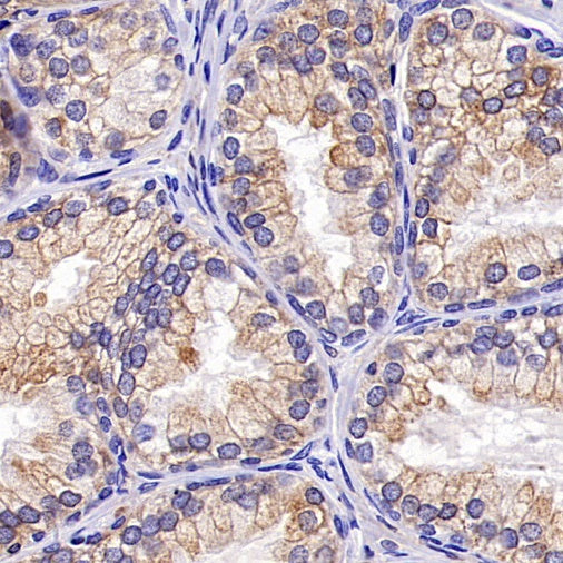 CD112/Nectin-2 Recombinant Rabbit mAb (S-2404-66)