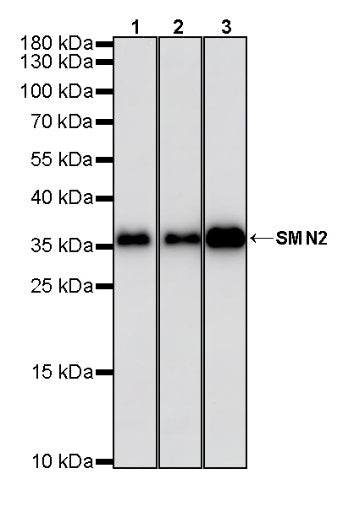 SMN2 Recombinant Rabbit mAb (S-4920-4)