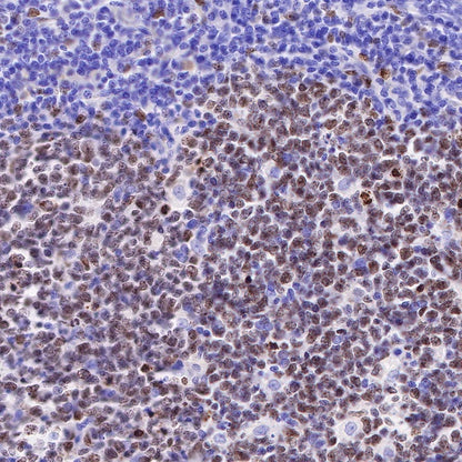 Ki67 Mouse mAb (SDT-606-33)