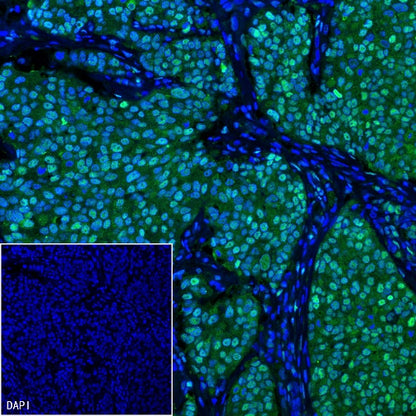 PRMT1 Recombinant Rabbit mAb (S-884-10)