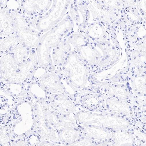 ALPP/ALPPL2 Recombinant Rabbit mAb (S-2089-36)