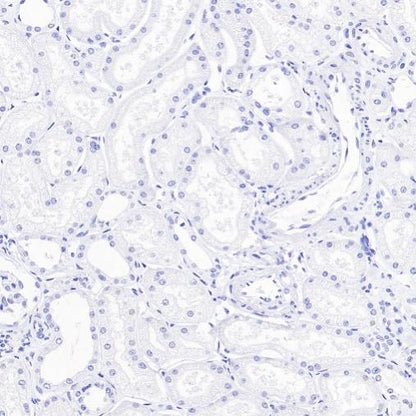 ALPP/ALPPL2 Recombinant Rabbit mAb (S-2089-36)
