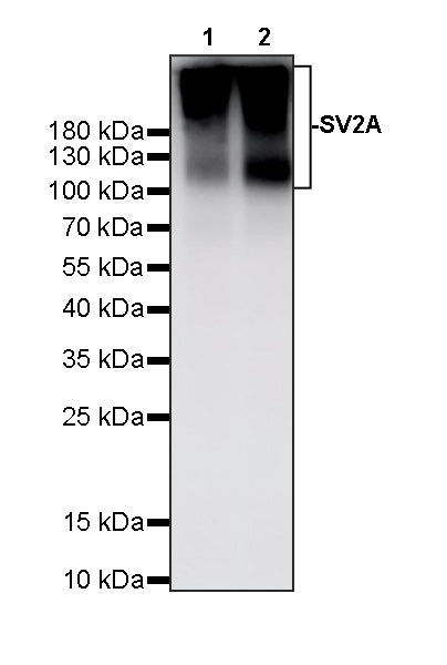 SV2A Recombinant Rabbit mAb (S-4049-16)