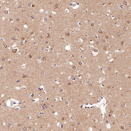 SFXN1/TCC Rabbit Polyclonal Antibody