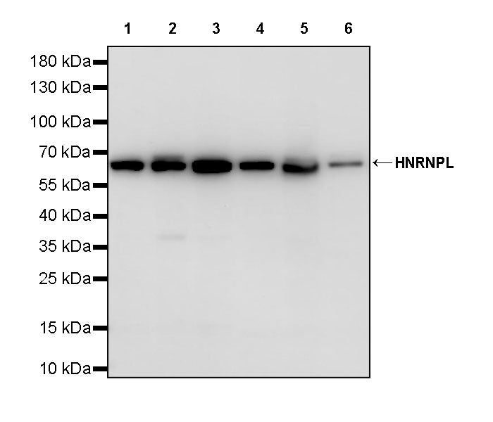 HNRNPL Rabbit Polyclonal Antibody