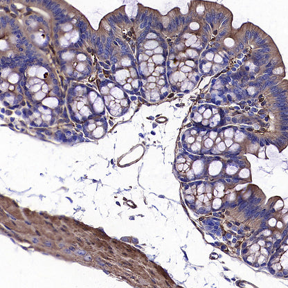 Vinculin Recombinant Rabbit mAb (S-5405)