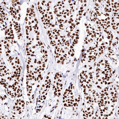 Nucleolin Rabbit Polyclonal Antibody