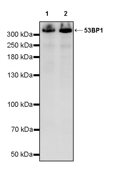 53BP1 Recombinant Rabbit mAb (S-3170-149)