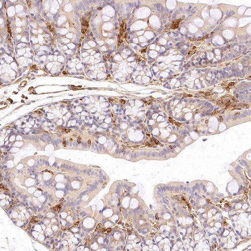 Talin-1 Recombinant Rabbit mAb (S-1483-25)