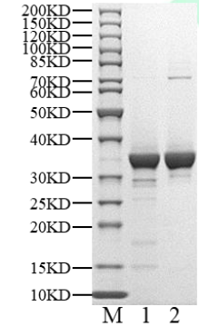 ERK3 (L290V) Protein, Human