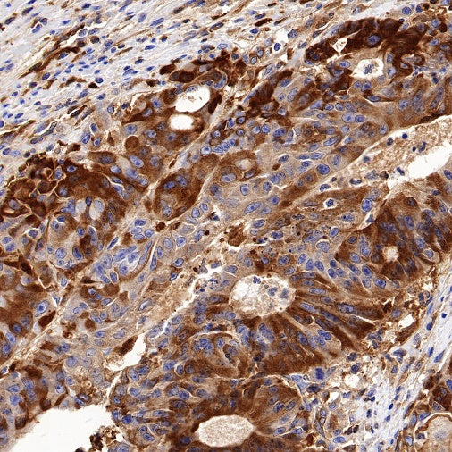 Citrate synthetase Recombinant Rabbit mAb (S-1708-56)