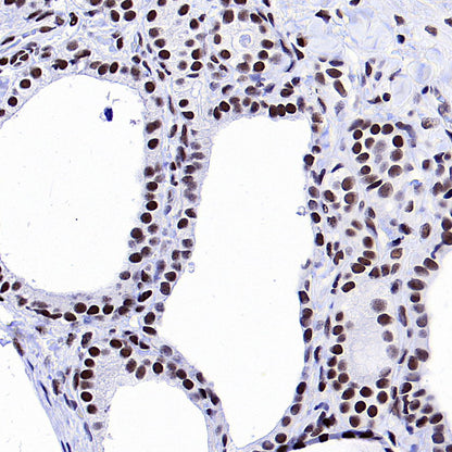 YY1 Recombinant Rabbit mAb (S-3652-44)