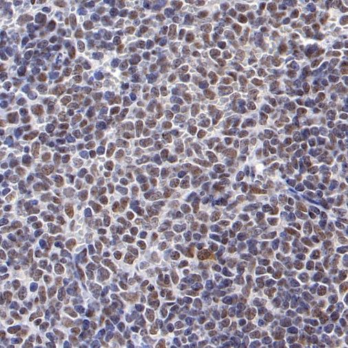 CDK9 Rabbit Polyclonal Antibody