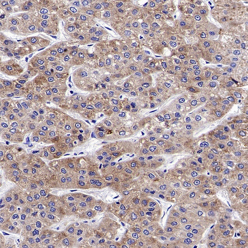 FACL4 Rabbit Polyclonal Antibody