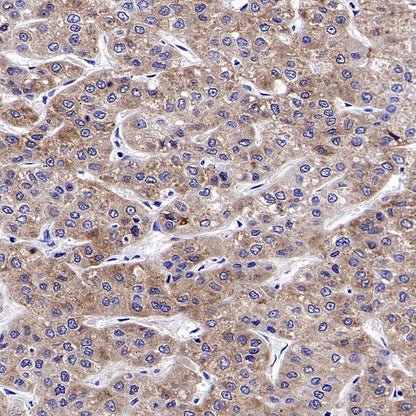 FACL4 Rabbit Polyclonal Antibody