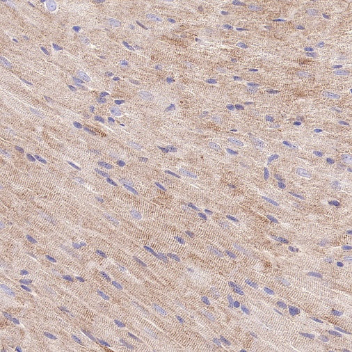 HADHA Recombinant Rabbit mAb (S-2345-8)
