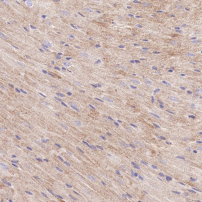 HADHA Recombinant Rabbit mAb (S-2345-8)
