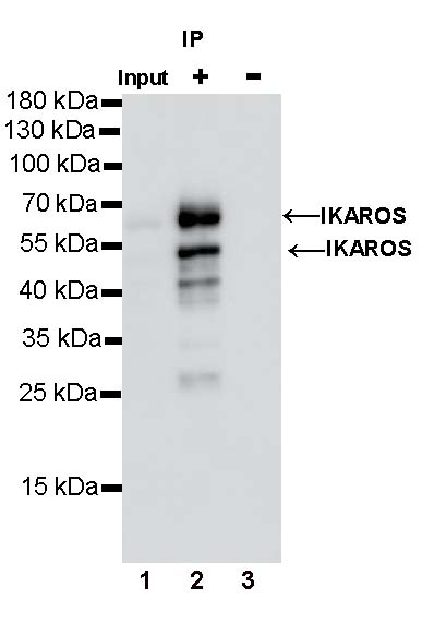 IKAROS Recombinant Rabbit mAb (S-729-146)