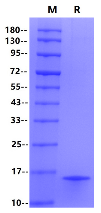Procalcitonin (PCT) His Tag Protein, Human