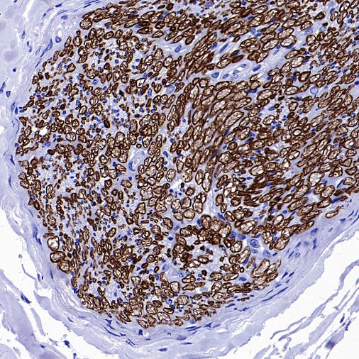 Myelin protein zero Recombinant Rabbit mAb (SDT-1225-8)