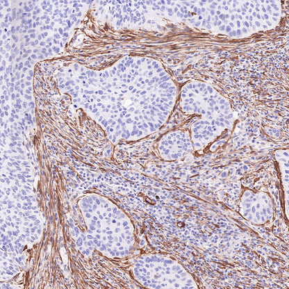 alpha smooth muscle Actin Recombinant Mouse mAb (SDT-R142)