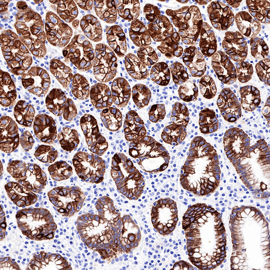 CK-LMW Recombinant Rabbit mAb (SDT-P003)