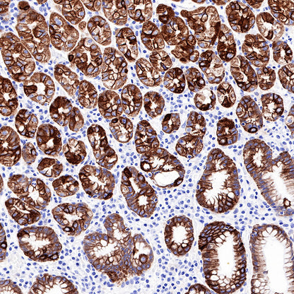 CK-LMW Recombinant Rabbit mAb (SDT-P003)