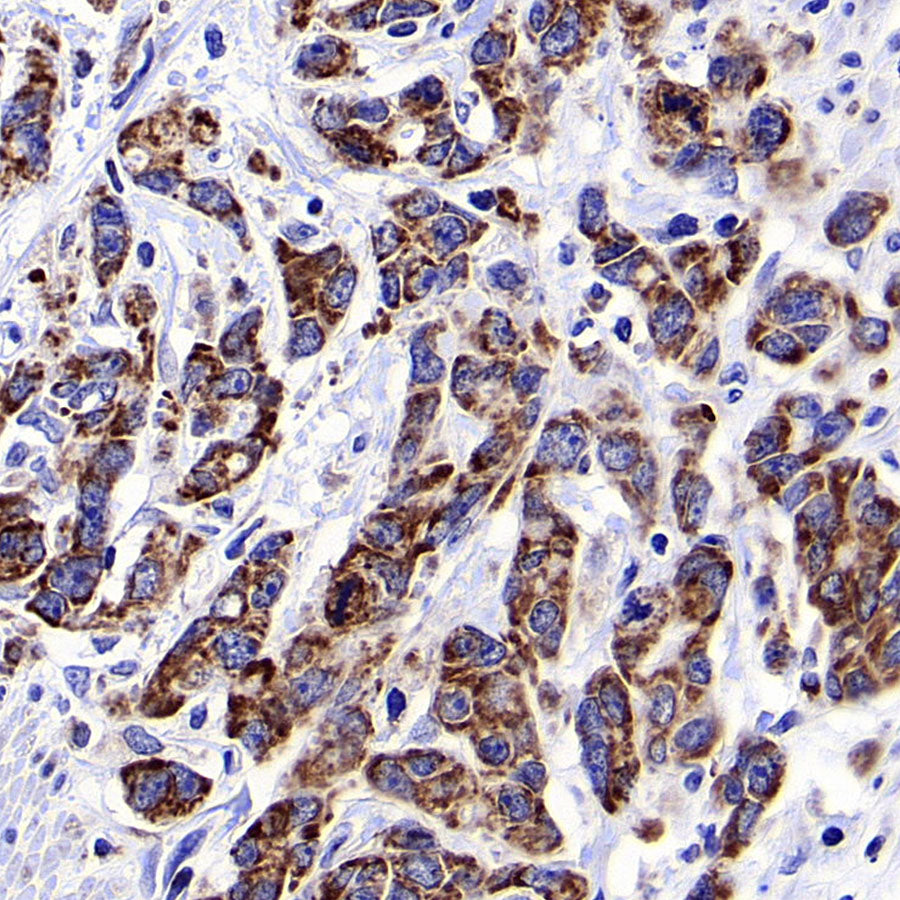 CHCHD2 Recombinant Rabbit mAb (S-4107-30)