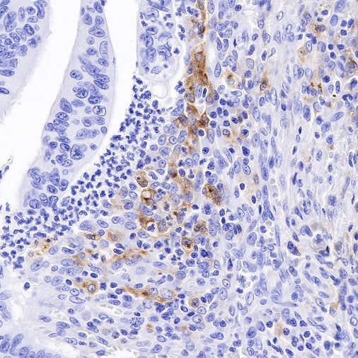 GPNMB Recombinant Rabbit mAb (S-491-6)