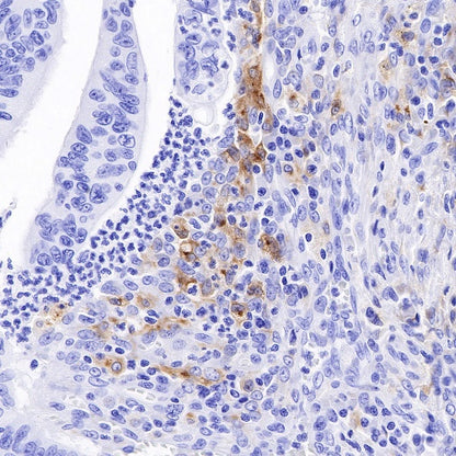GPNMB Recombinant Rabbit mAb (S-491-6)