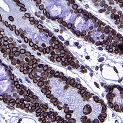 Lamin B1 Recombinant Mouse mAb (S-4865)