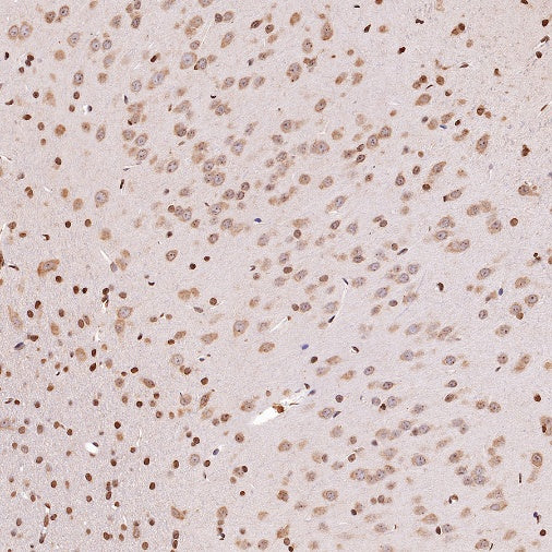 Superoxide Dismutase 1 Recombinant Rabbit mAb (S-1537-39)