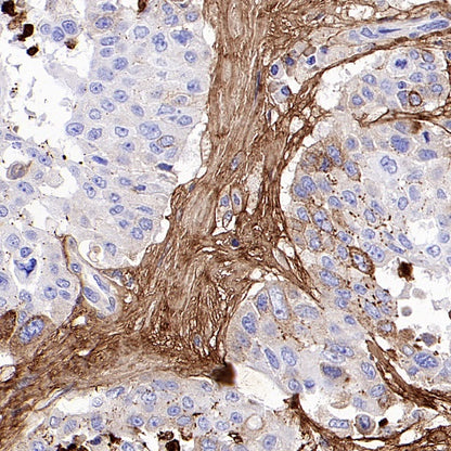 Tenascin C Recombinant Rabbit mAb (S-775-274)
