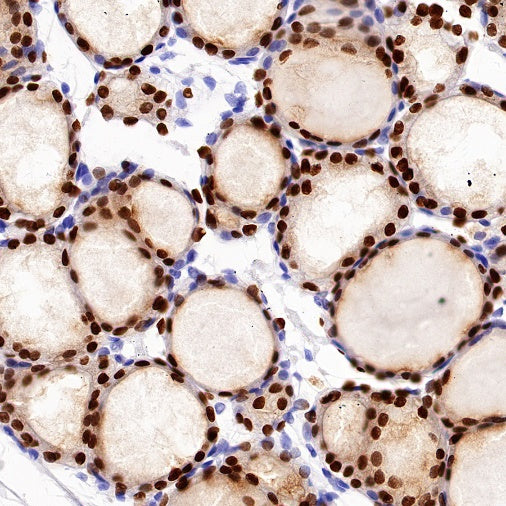 PAX8 Recombinant Rabbit mAb (SDT-R509)