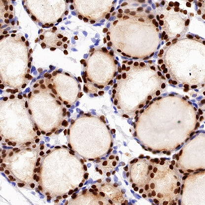 PAX8 Recombinant Rabbit mAb (SDT-R509)