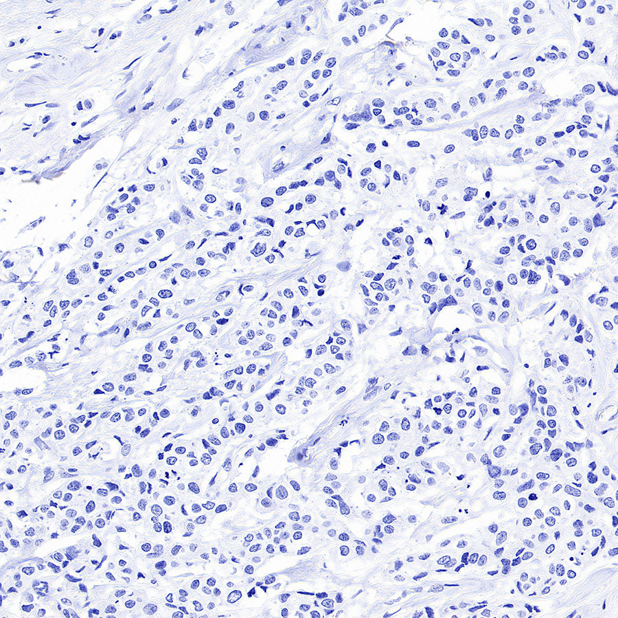 CDH17 Recombinant Rabbit mAb (SDT-3276-46)