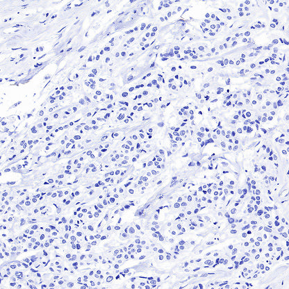 CDH17 Recombinant Rabbit mAb (SDT-3276-46)