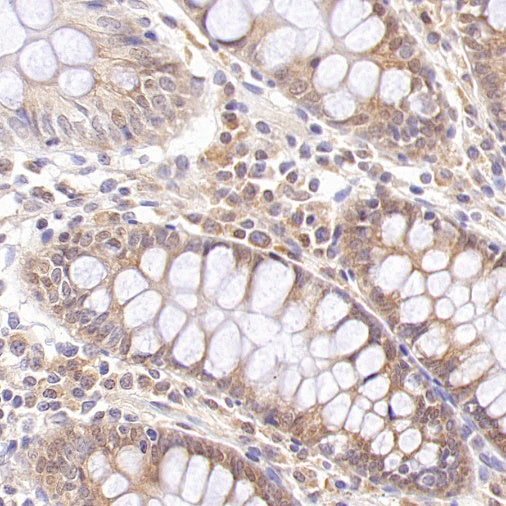 Smyd3 Recombinant Rabbit mAb (S-1507-61)