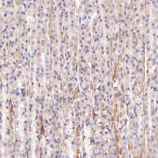 Integrin alpha V Recombinant Rabbit mAb (S-1798-27)