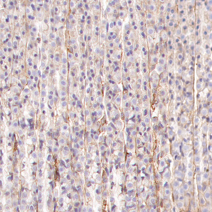 Integrin alpha V Recombinant Rabbit mAb (S-1798-27)
