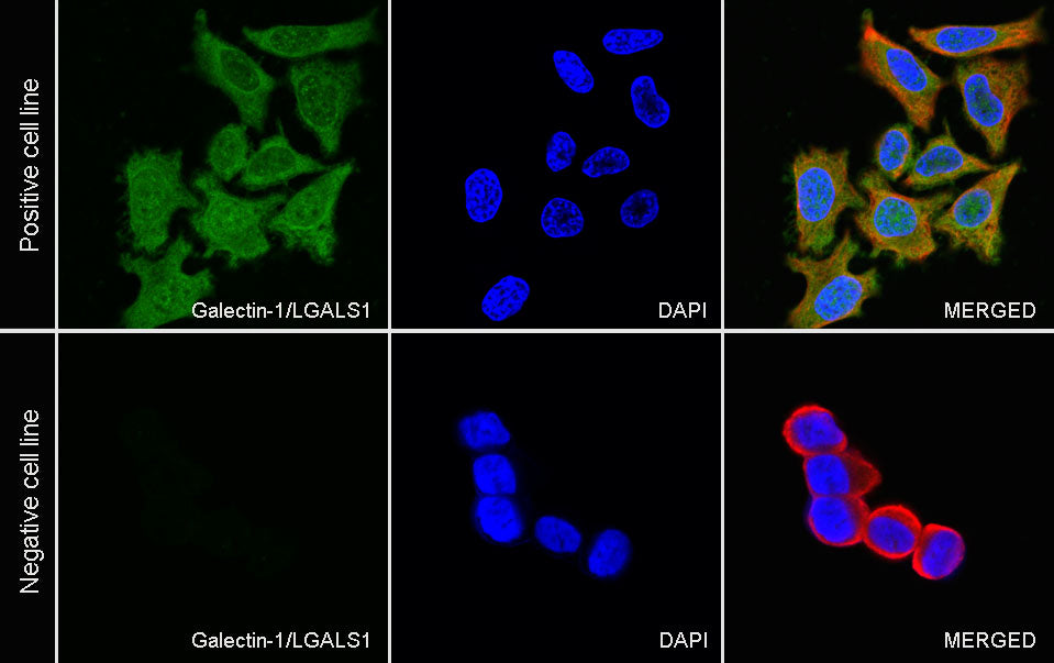 Galectin-1 Recombinant Rabbit mAb (S-1221-32）