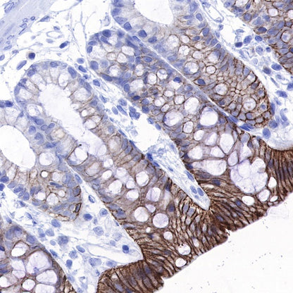 S-RMab® Cadherin 17 Recombinant Rabbit mAb (SDT-736-23)