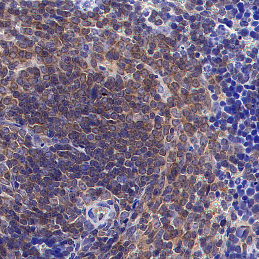 NF-kB p65 Recombinant Rabbit mAb (S-5142)