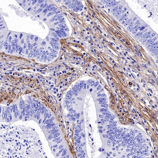 Fibronectin Recombinant Rabbit mAb (S-1475-79)