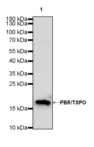 PBR/TSPO Recombinant Rabbit mAb (S-607-19)