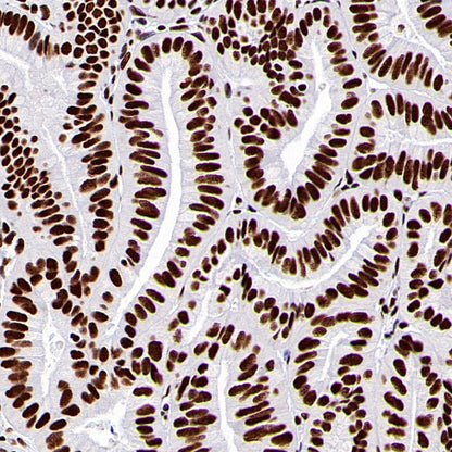 ARID1A Recombinant Rabbit mAb (S-440-27)