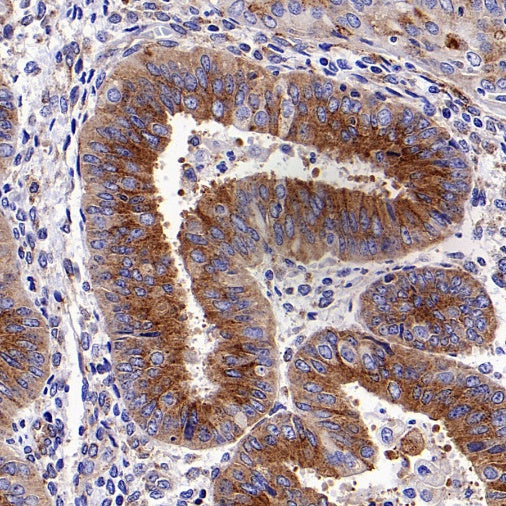 M6PR Recombinant Rabbit mAb (S-1480-21)