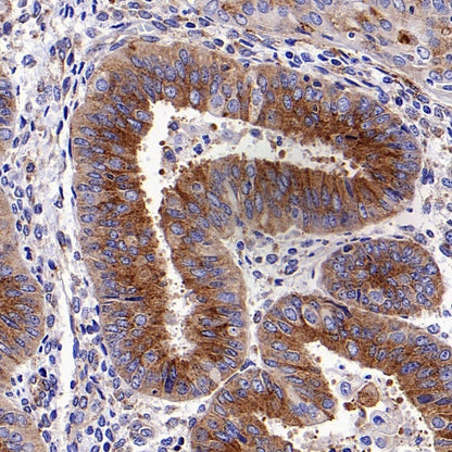 M6PR Recombinant Rabbit mAb (S-1480-21)