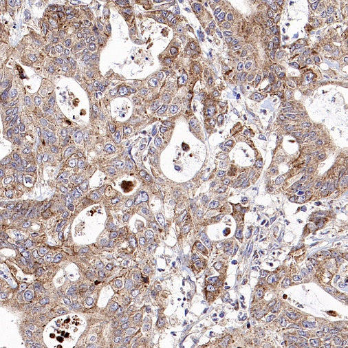 Mitofusin 2 Recombinant Rabbit mAb (S-1783-49)